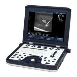 P5 SIGMA ULTRASOUND